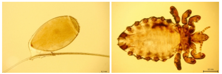 <p><strong>Haematopinus eurysternus</strong></p><ul><li><p>hemimetabolic (egg, 3 nymphal stages, adult)</p></li><li><p>type: permanent, specific</p></li><li><p>DH: cattle</p></li></ul><p>Adult: wingless body, dorso-ventrally flattened, divided into head, thorax and abdomen, 3 pair of limbs, one claw at the end of limbs, sucking mouthparts, head narrower than abdomen, antennae composed of five segments, no eyes. </p><p>All development stages (except egg) can suck blood.</p>