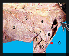 <p>Identify what the brown arrow is pointing to; also labeled number &quot;5, 4 and 3&quot;</p>