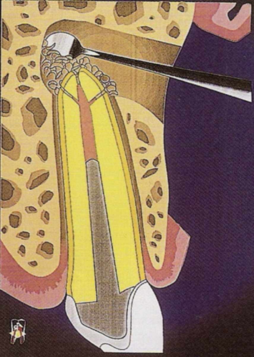 <p>ID the surgical procedure:</p>