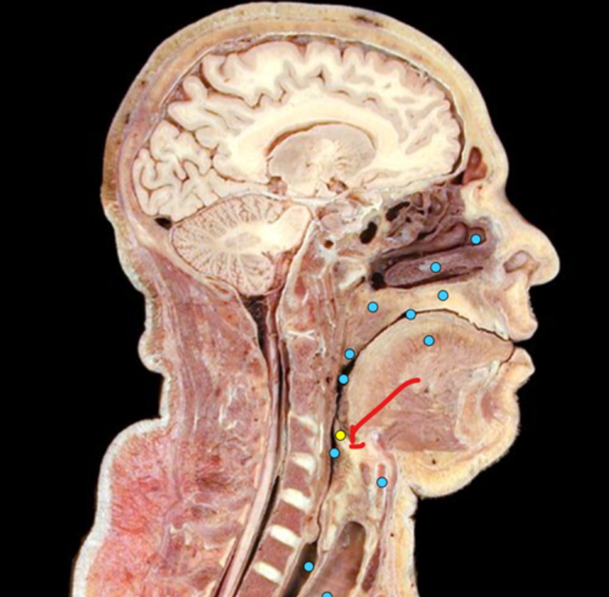 knowt flashcard image