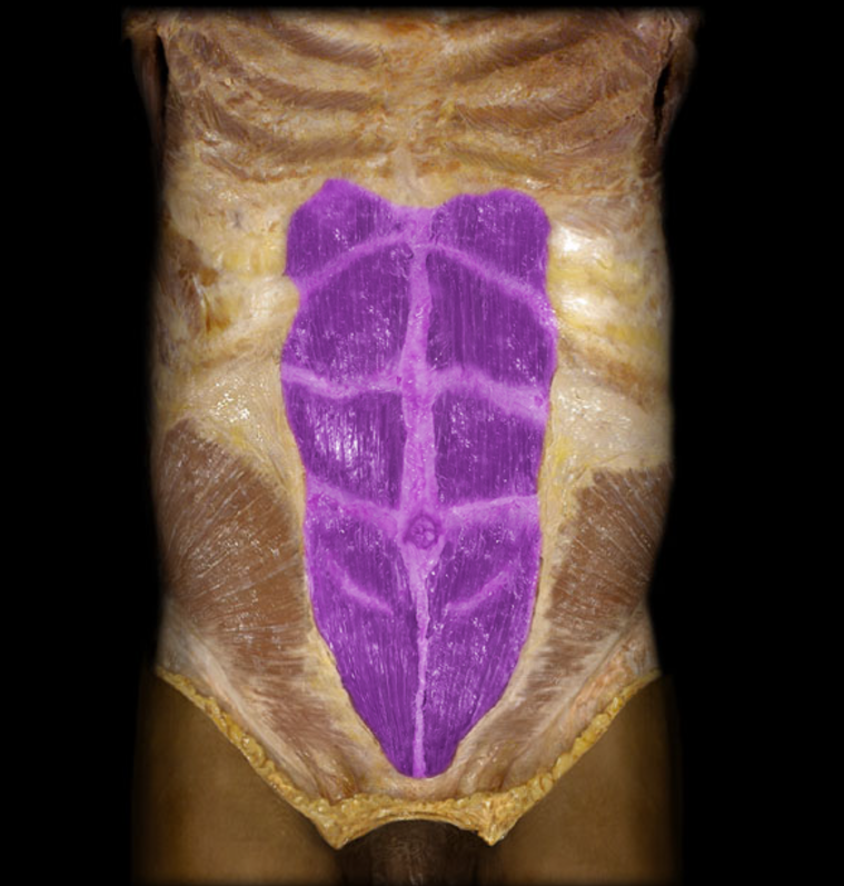 <p>Rectus abdominis</p>