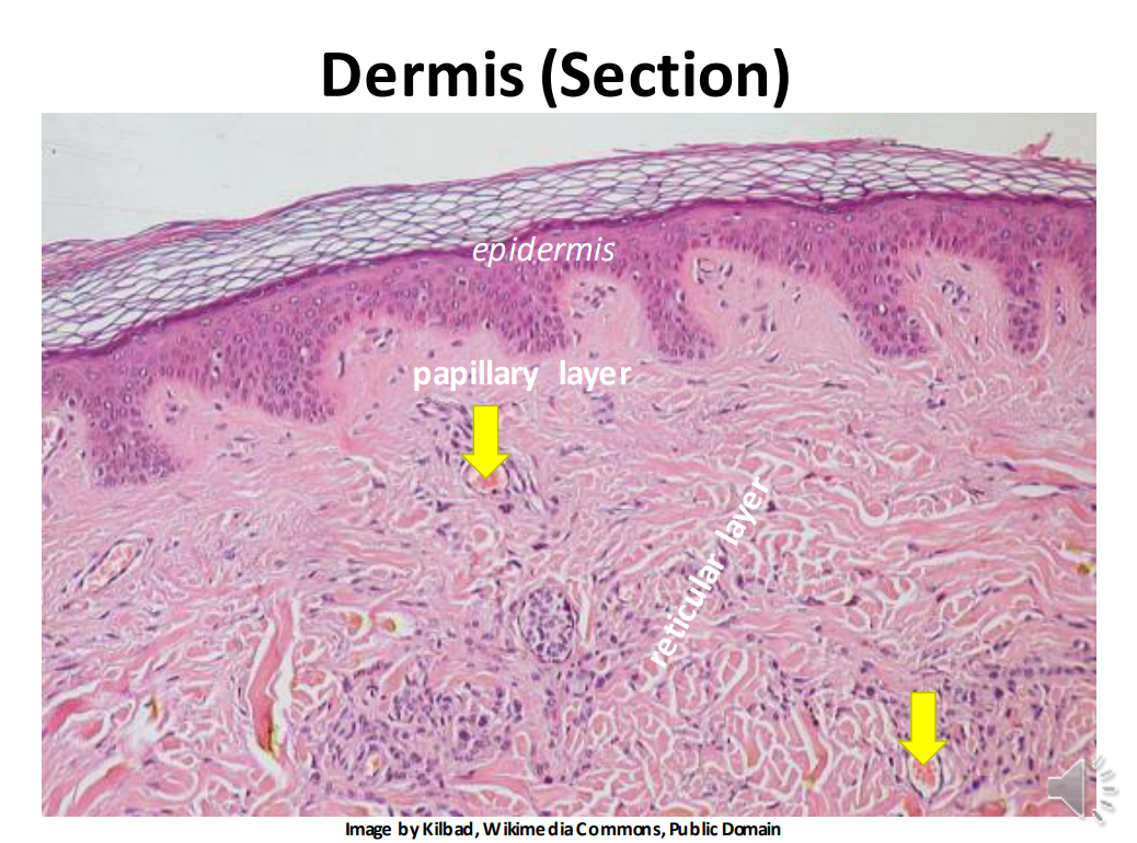 <p>papillary</p>