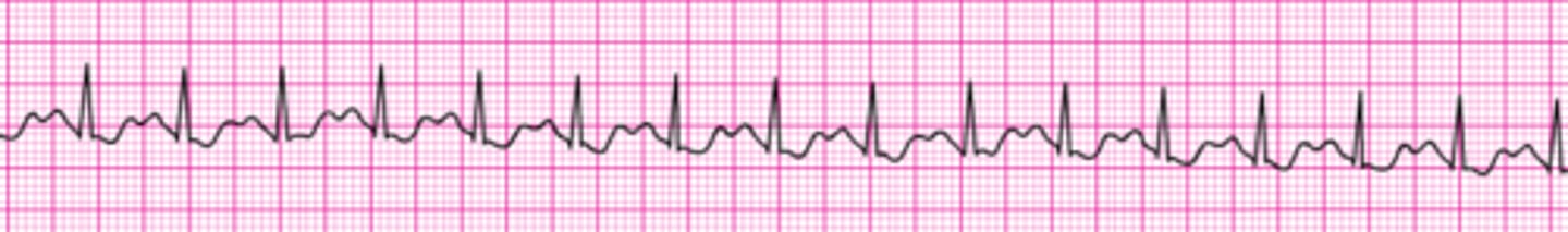 <p>Vagal maneuvers</p>