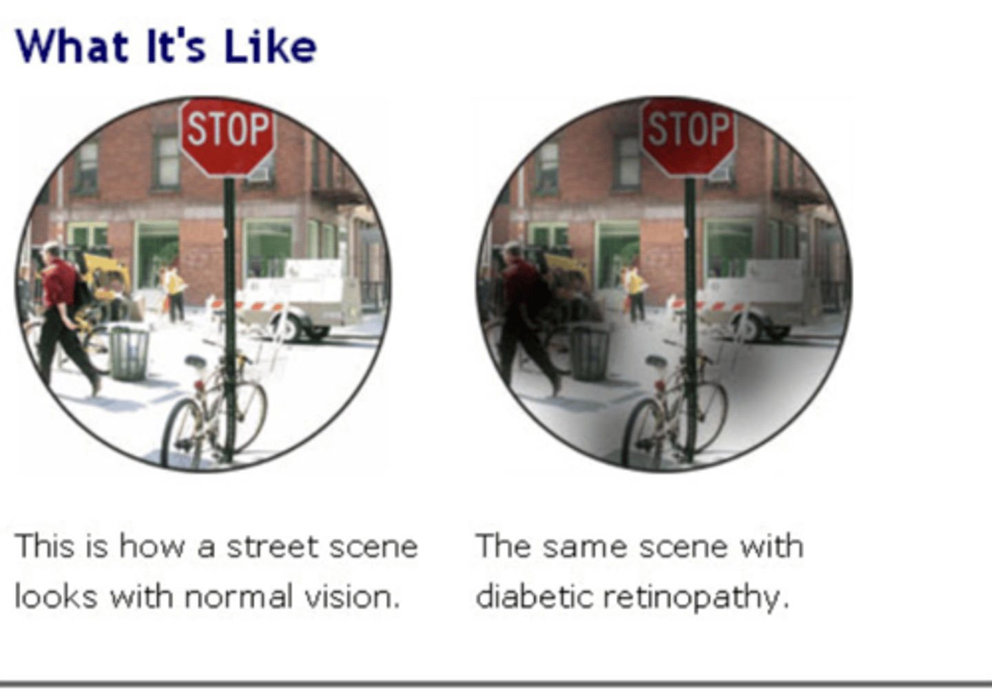<p>laser tx</p><p>sx</p>