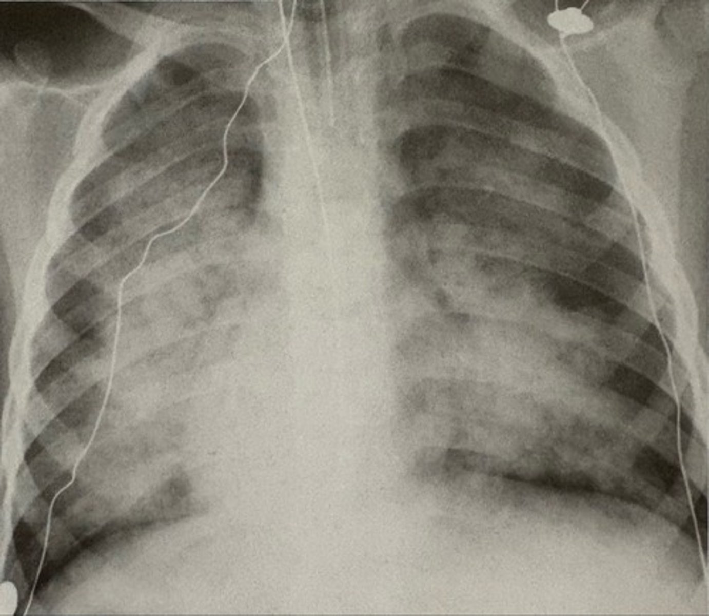 <p>what pathology is present?</p>