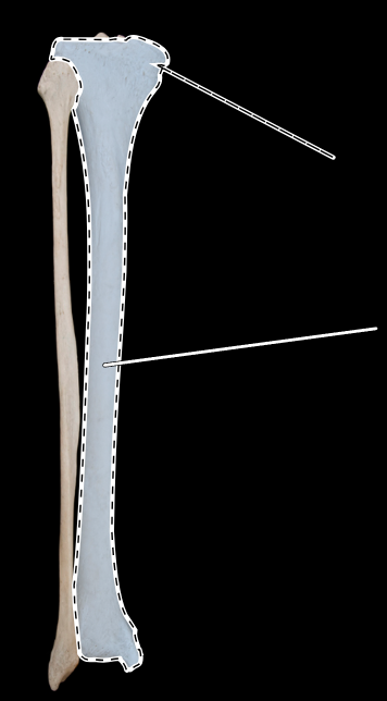 <p>Name this bone.</p><p>(Posterior view).</p>
