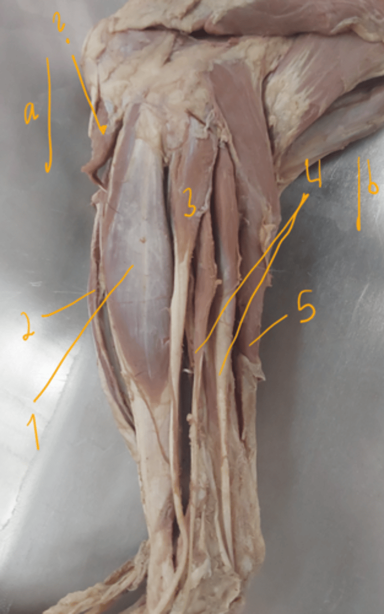 <p>identify muscles. which muscle is not seen here?</p>