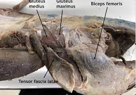 <p>Origin: Fascia over sacrum</p><p>Insertion: Lateral surface of femur</p><p>Action: Abducts thigh</p>