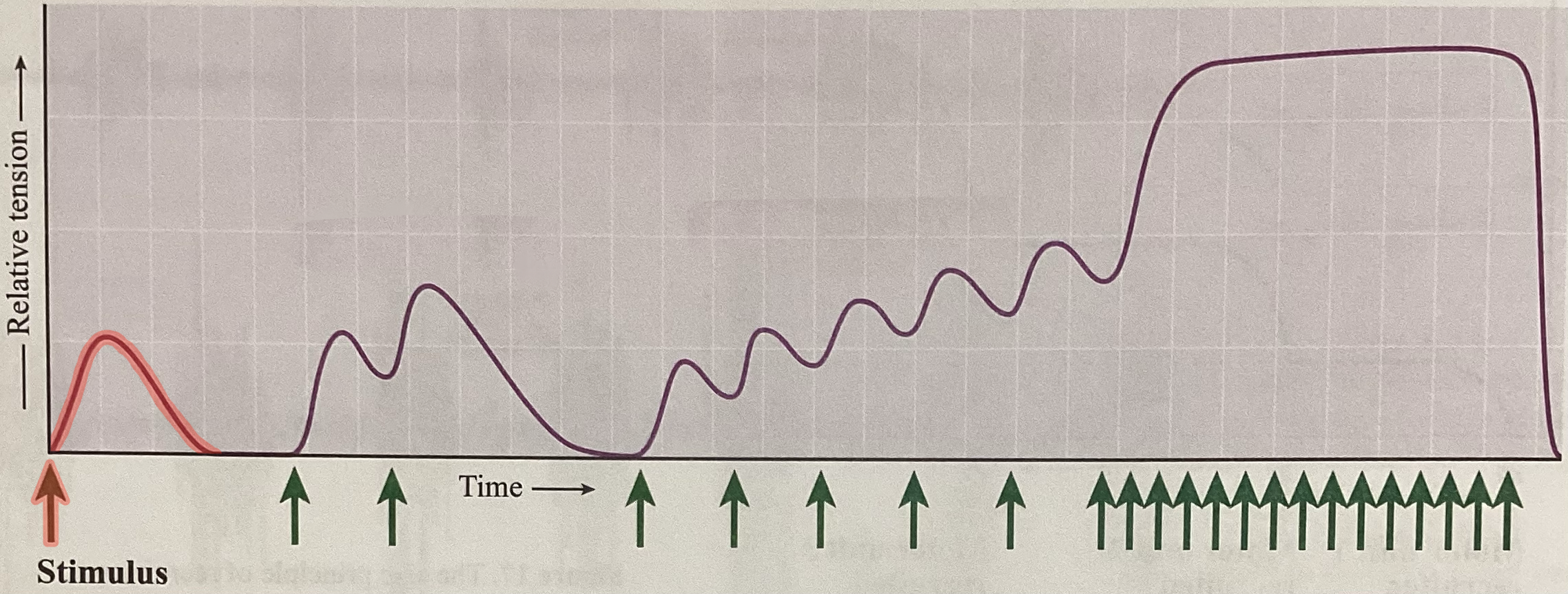 <p>What type of contraction is this?</p>