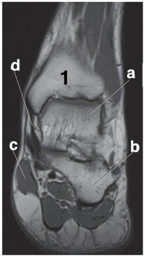 <p>Which letter is the talus?</p>