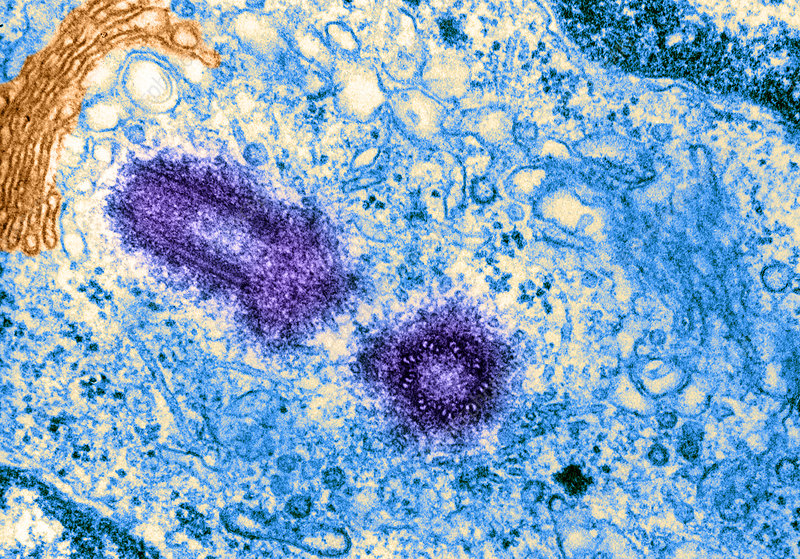 <p>Centrosome - (micrograph structure of this pictured below)</p>