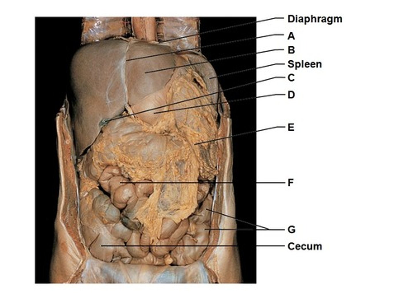 <p>A = ?</p>