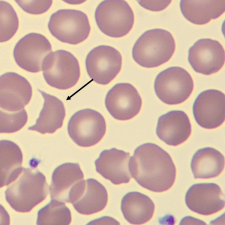 <p>What is the shape of this erythrocyte?</p>