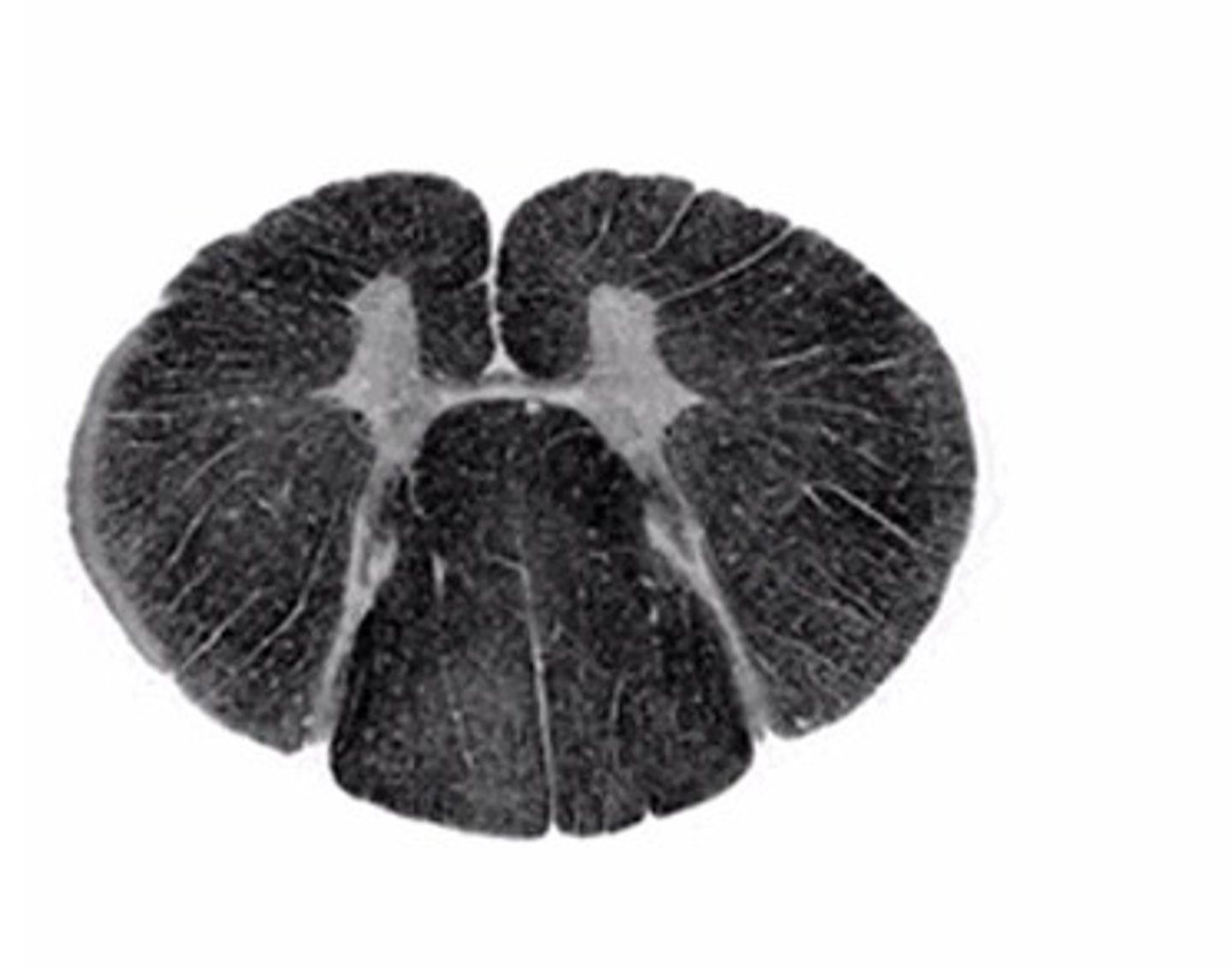 <p>Identify the spinal cord level</p>