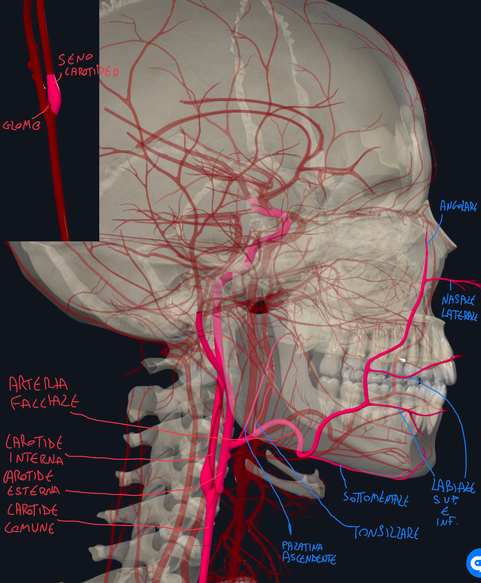 <p>CAROTIDE COMUNE:</p><ul><li><p>A dx origina dal tronco brachiocefalico, mentre a&nbsp;sx origina dall’arco aortico</p></li><li><p>Risale verticalmente nel collo fino al livello del margine superiore della cartilagine tiroidea della laringe (pomo d’Adamo o a livello della C4) dove biforca in una CAROTIDE INTERNA ED ESTERNA</p></li><li><p>Quella interna sale verso l’encefalo senza emettere ramificazioni nel collo, mentre quella esterna emette diversi rami, tra cui l’ARTERIA FACCIALE</p></li></ul><p>ARTERIA FACCIALE:</p><ul><li><p>Decorso → prosegue dietro l’angolo della mandibola → ne scavalca il margine inferiore del corpo e risale obliquamente fino all’angolo mediale dell’occhio</p></li><li><p>In questo, emette diversi rami che dividiamo in cervicali e facciali</p></li><li><p>Quelle Cervicali sono la Palatina Ascendente, la Tonsillare e la Sottomentale (PTS)</p></li><li><p>Mentre quelle Facciali sono la Labiale inferiore e superiore, la Nasale Laterale e la Angolare (la angolare comunica con rami oftalmici → anastomosi carotide interna ed esterna).</p></li><li><p>E’ possibile palparne la pulsazione quando supera la mandibola in corrispondenza del margine anteriore del massetere</p></li></ul><p></p><p>N.B.</p><p>A livello della biforcazione, in associazione alla carotide interna, osserviamo dei rigofiamenti, cioè il Seno Carotideo (barocettore per la PA) e il Glomo Carotideo (chemiocettore per le concentrazioni di gas) che sono in questa posizione strategica perché è la carotide interna che irrora la cavità cranica</p><p></p><p></p><p></p>