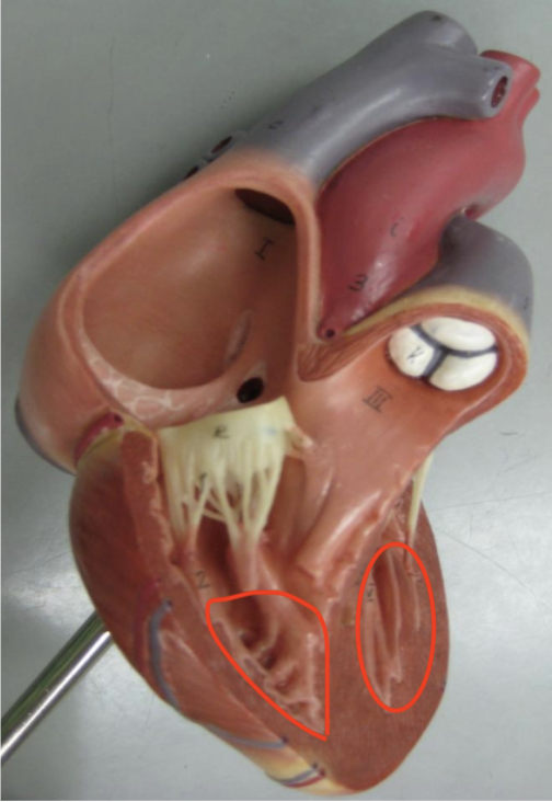 <p>ridges on the walls of both ventricles </p>