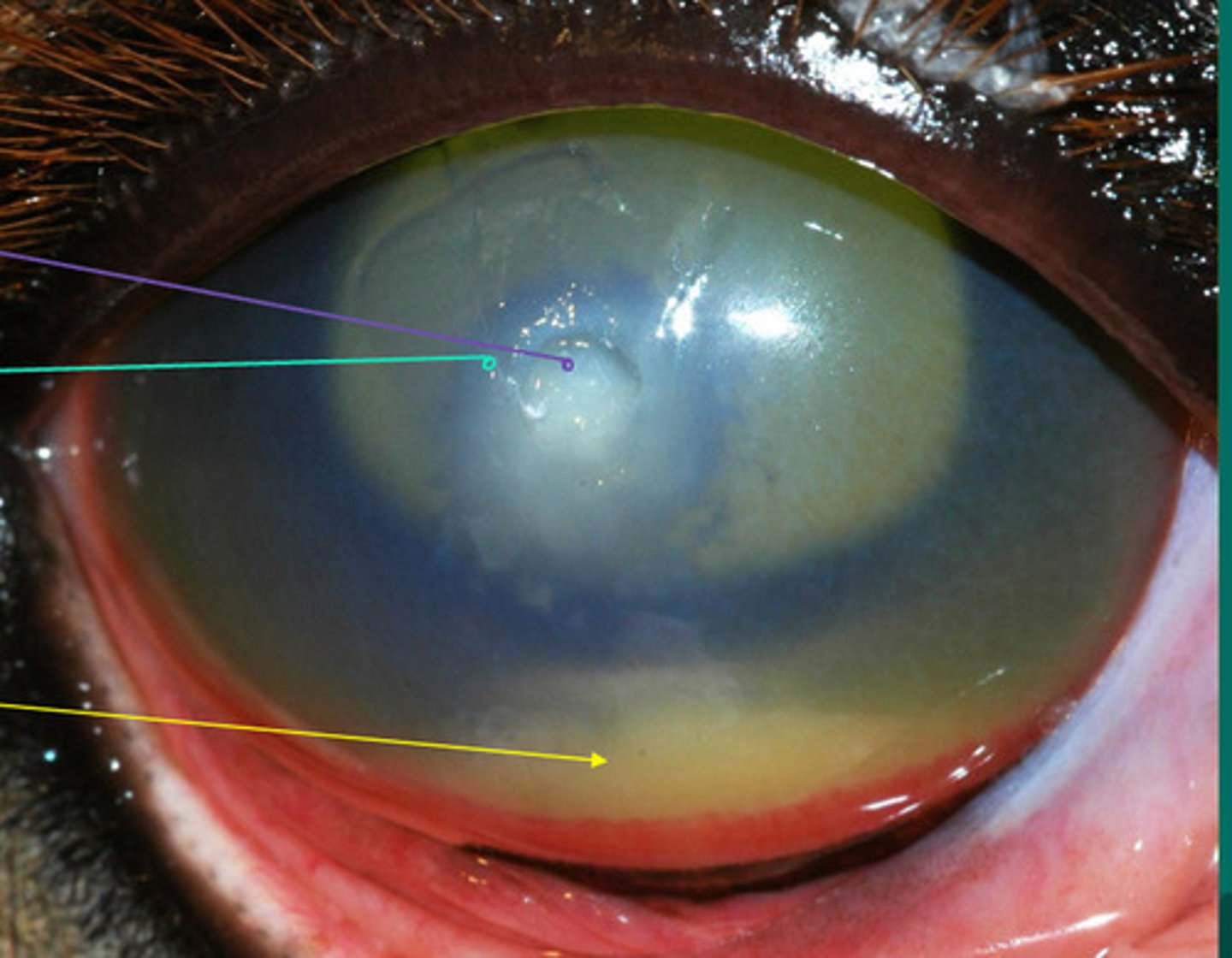 <p>What are the different arrows pointing to?</p>