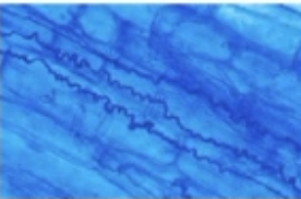the blue squiggly lines