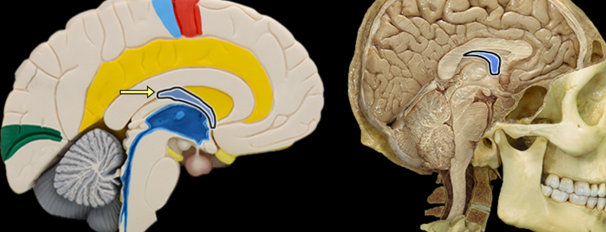 <p>Fornix of brain</p>