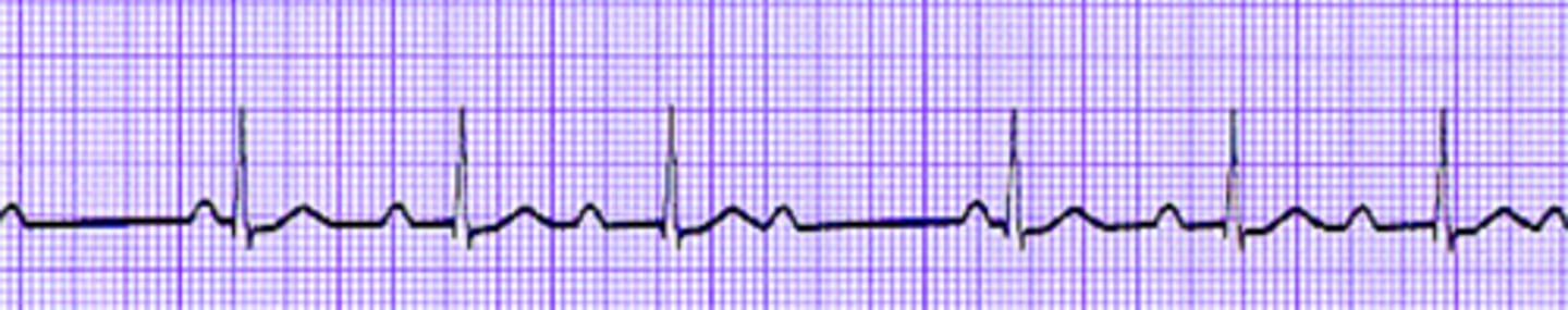<p>Name the rhythm</p>