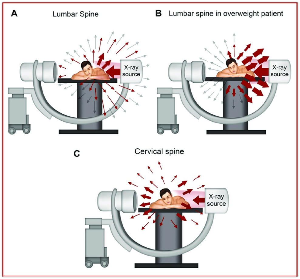 <p>The patient is our source of dose - where is their scatter direction </p>