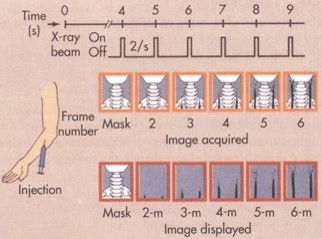 <p><span>This image represents what type of digital subtraction technique and method? (Select all that apply)</span></p>