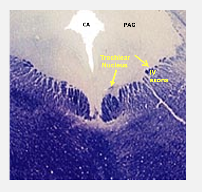 <p>CN#4; somatic motor - axons leaving this nucleus course dorsally where they cross on the midline, axons innervate the superior oblique muscle in the orbit </p>