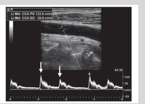 <p>what is this waveform showing?</p>