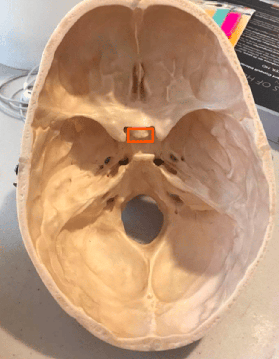 <p><em>identify the structure:</em></p>