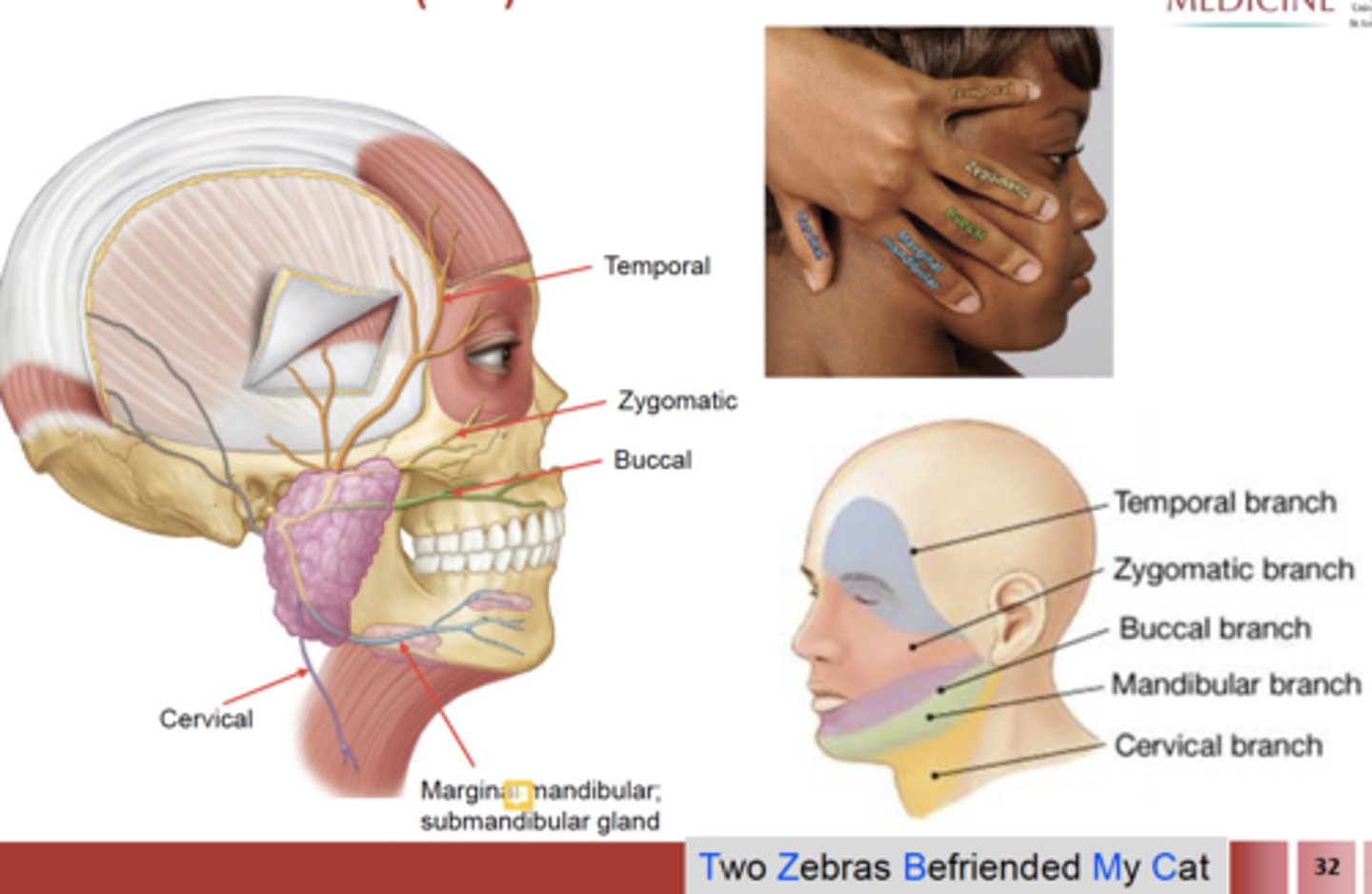 <p>Temporal</p><p>Zygomatic</p><p>Buccal</p><p>Mandibular</p><p>Cervical</p><p>The Zebra Bit My Cookie</p>