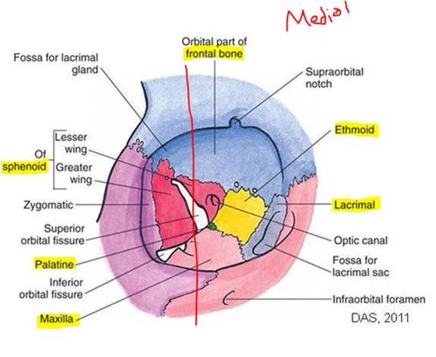 <p>Thinnest orbital wall, vulnerable to fracture; separates orbit from ethmoid sinus.</p>