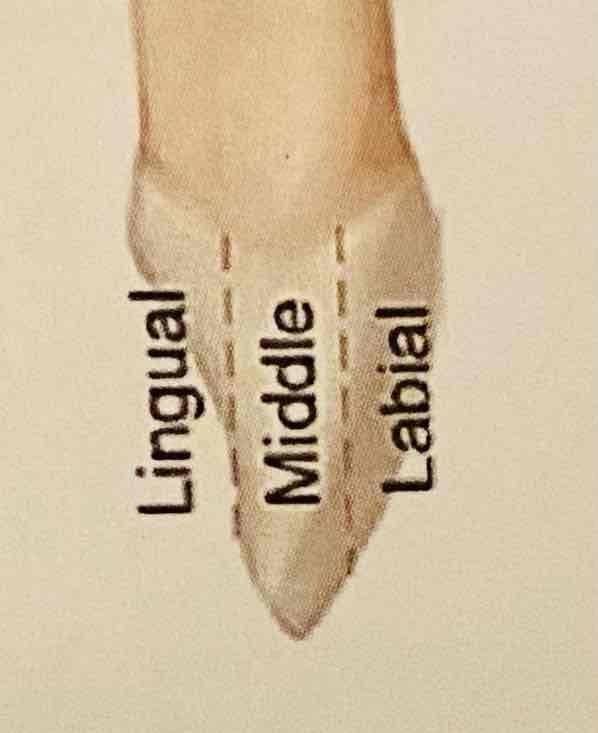 <ul><li><p>Linguaal (tongzijde)</p></li><li><p>Midden</p></li><li><p>Labiaal (voortandzijde)</p></li></ul>