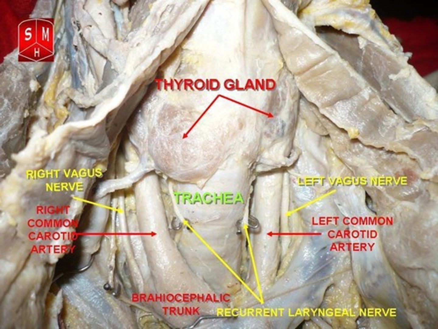 <p>Study of certain parts of the body in greater details employing with the use of electron microscope.</p>