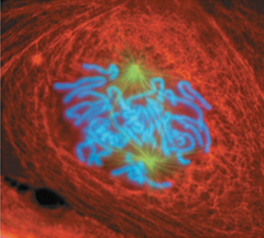 <p>What stage of mitosis is shown here?</p>