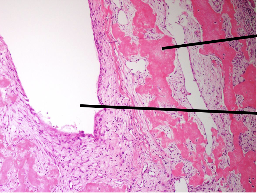 <p>Lable top to bottom and diagnose</p>