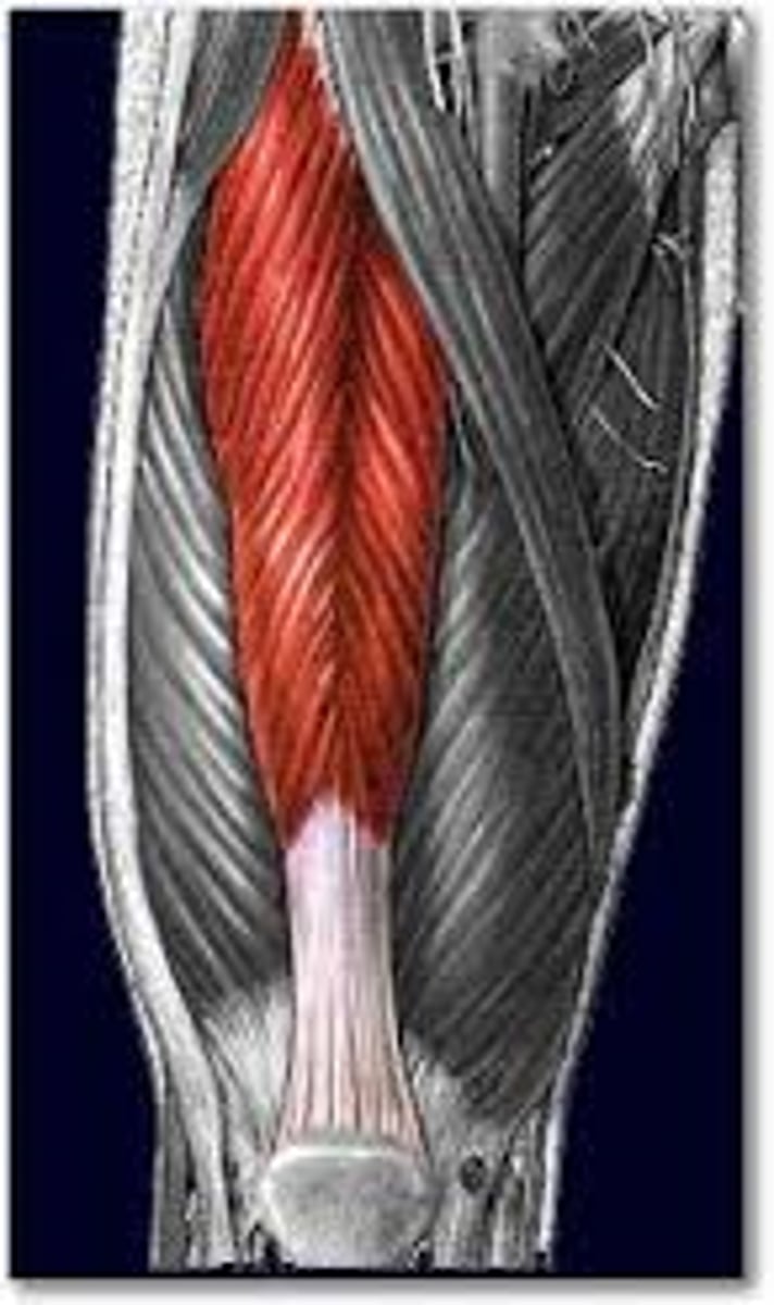 <p>most superficial quad muscle, fibers run up and down</p>