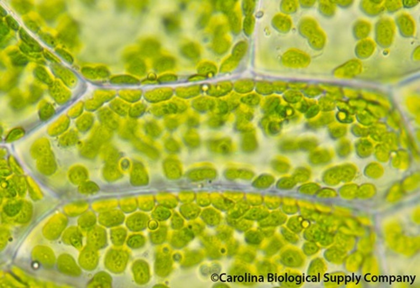 <p>A green pigment of the plant cell. This is the construction site of photosynthesis. Contains chlorophyll which contains thylakoid.</p>