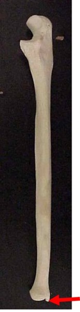 <p>projection</p><p>below pinky under head</p>