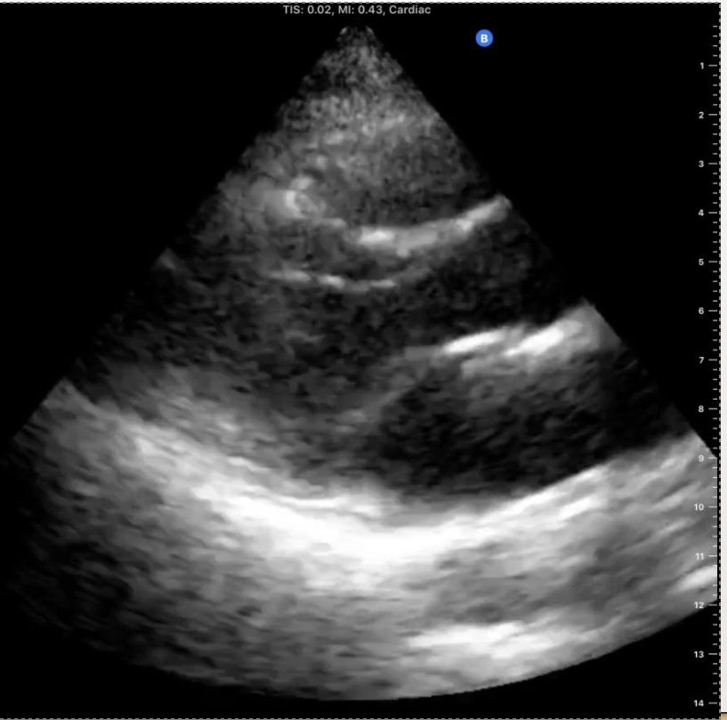 <p>Identify the view and the structures on this echo</p>