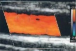 <p>If we are talking about color wall filter, explain why the vessel appears this way. (2)</p>