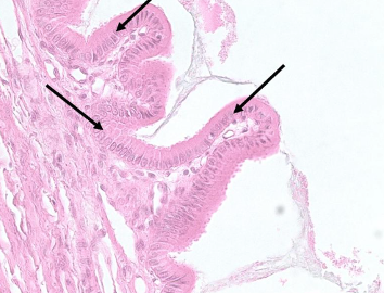 <p>What type of tissue is this?</p>