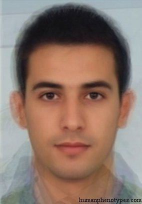 <p>Identify this Phenotype</p>