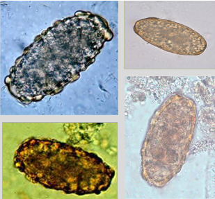 <ul><li><p><span>90 x 40 um</span></p></li><li><p><span>Oval, yellow brown stained</span></p></li><li><p><span>Thick shell, may be corticated (albuminous coating)</span></p></li><li><p><span>Undifferentiated internal material</span></p></li><li><p><span><u>If only see these, the host is only infected with FEMALE worms</u></span></p></li></ul><p></p>