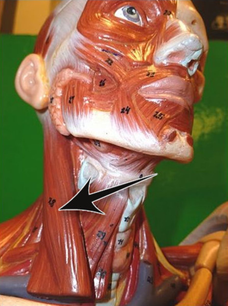 <p>Origin: Sternal end of clavicle and manubrium</p><p>Insertion: Mastoid process of temporal bone</p><p>Action: Single - Lateral flexion; rotation to opposite side</p><p>Dual - Neck flexion</p>