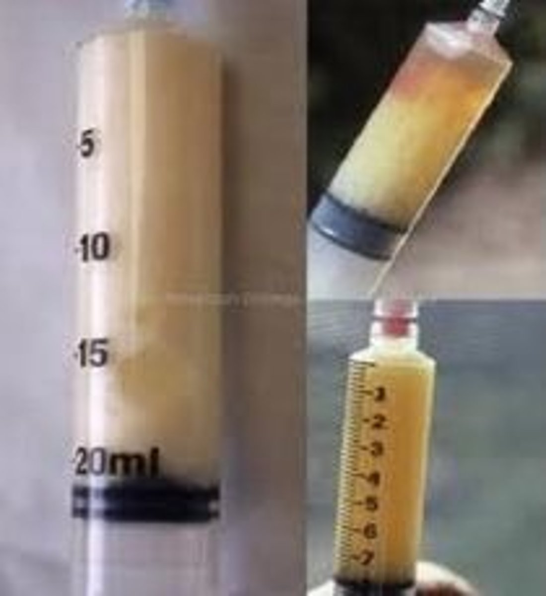 <p>surgical puncture of a joint</p>