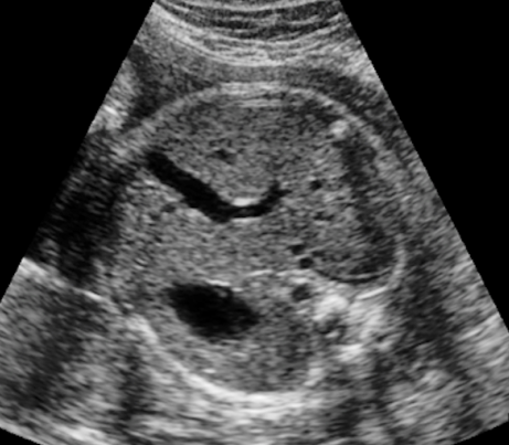 <p><span style="line-height: 21.6px;"><strong>Evaluate fetal situs</strong>; what is the presentation of the image?</span></p>