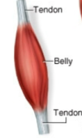 <p>Name this fascicle arrangement:</p>