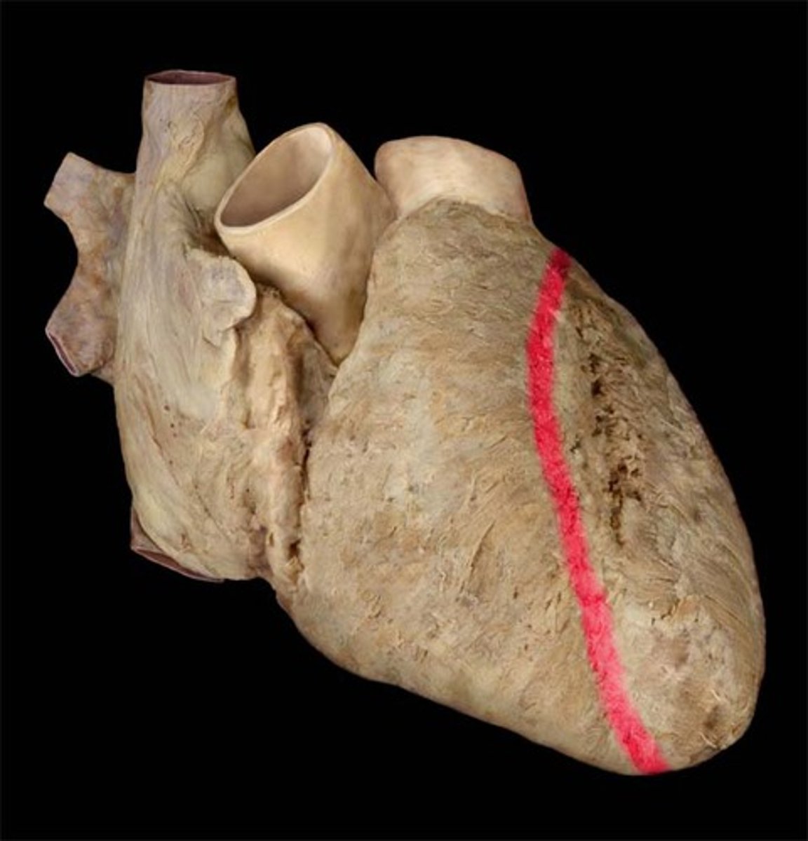 <p>separates ventricles of the heart on the anterior side</p>