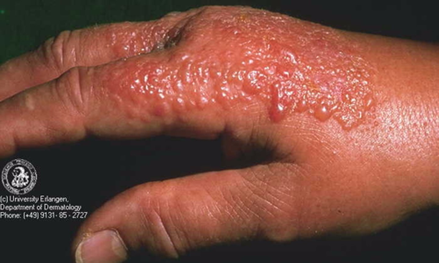 <p>non-specific immunity</p>