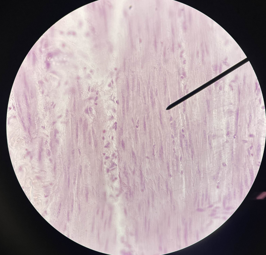 <p>What muscle is this?</p>